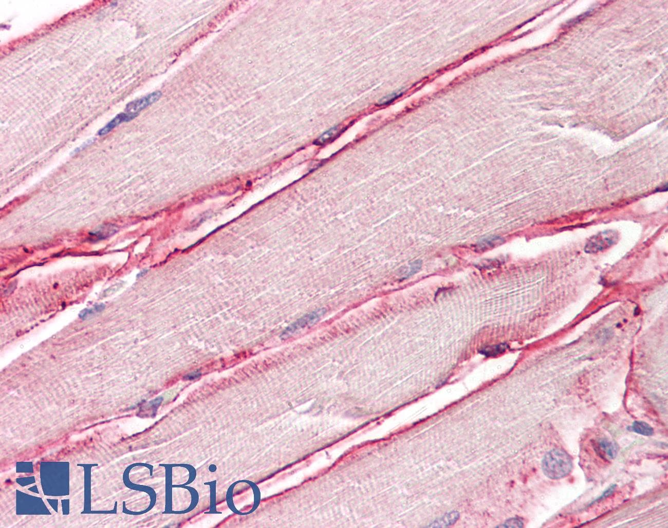IHC-plus™ Polyclonal Goat anti-Human SGCD / Delta-Sarcoglycan Antibody (aa244-256, IHC, WB)