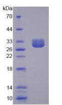 Human GOB5 / CLCA1 Protein (Recombinant His, N-Terminal)