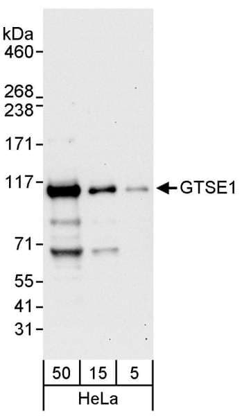 GTSE1 Antibody (aa670-720)