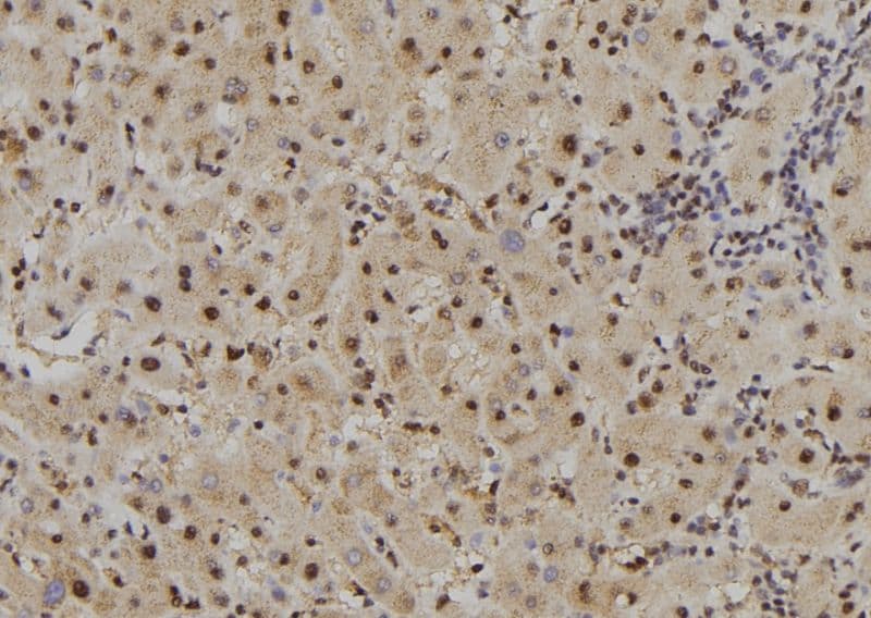 Polyclonal Rabbit anti-Human FAM160B2 / RAI16 Antibody (IHC, WB)