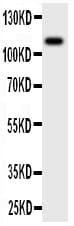 Polyclonal Rabbit anti-Human CSF1R / CD115 / FMS Antibody (aa955-972, WB)