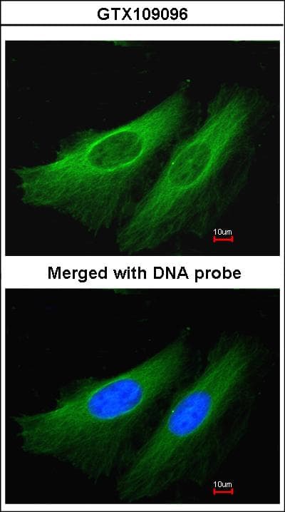 Polyclonal Rabbit anti-Human HMGCL Antibody (aa1-325, IHC, WB)