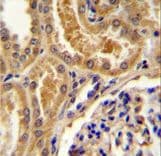 Polyclonal Rabbit anti-Human TLL2 Antibody (aa298-328, IHC, WB)