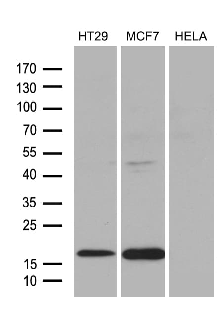 Monoclonal Mouse anti-Human AGR2 Antibody (clone OTI2G8, aa21-175, WB)