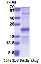 Human ZNHIT3 Protein (Recombinant His)
