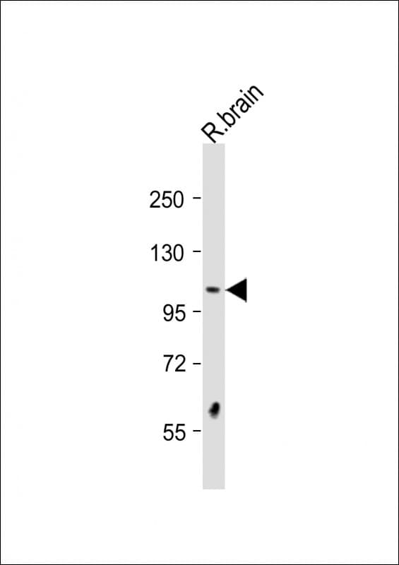Polyclonal Rabbit anti-Human DSTYK / RIPK5 Antibody (aa256-290, WB)