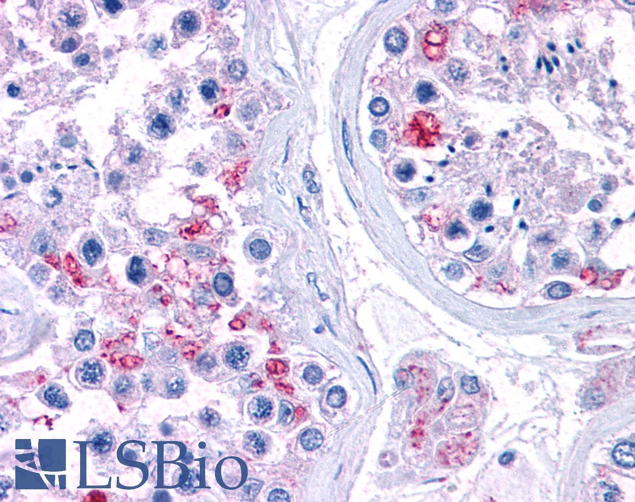 IHC-plus™ RPL22 / Ribosomal Protein L22 Antibody (aa106-119)