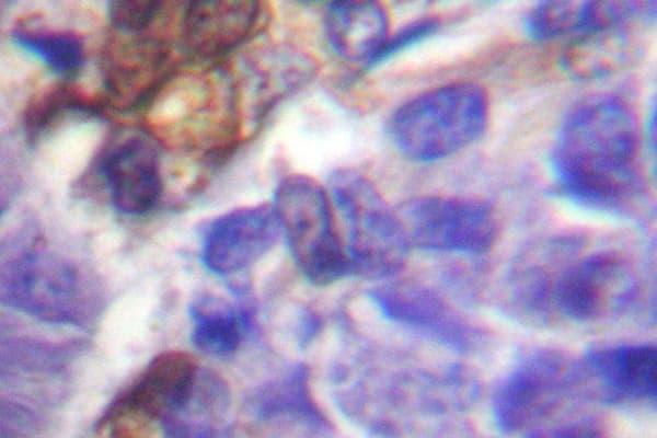 Polyclonal Rabbit anti-Human RPS6KA5 / MSK1 Antibody (Met355, IHC, WB)