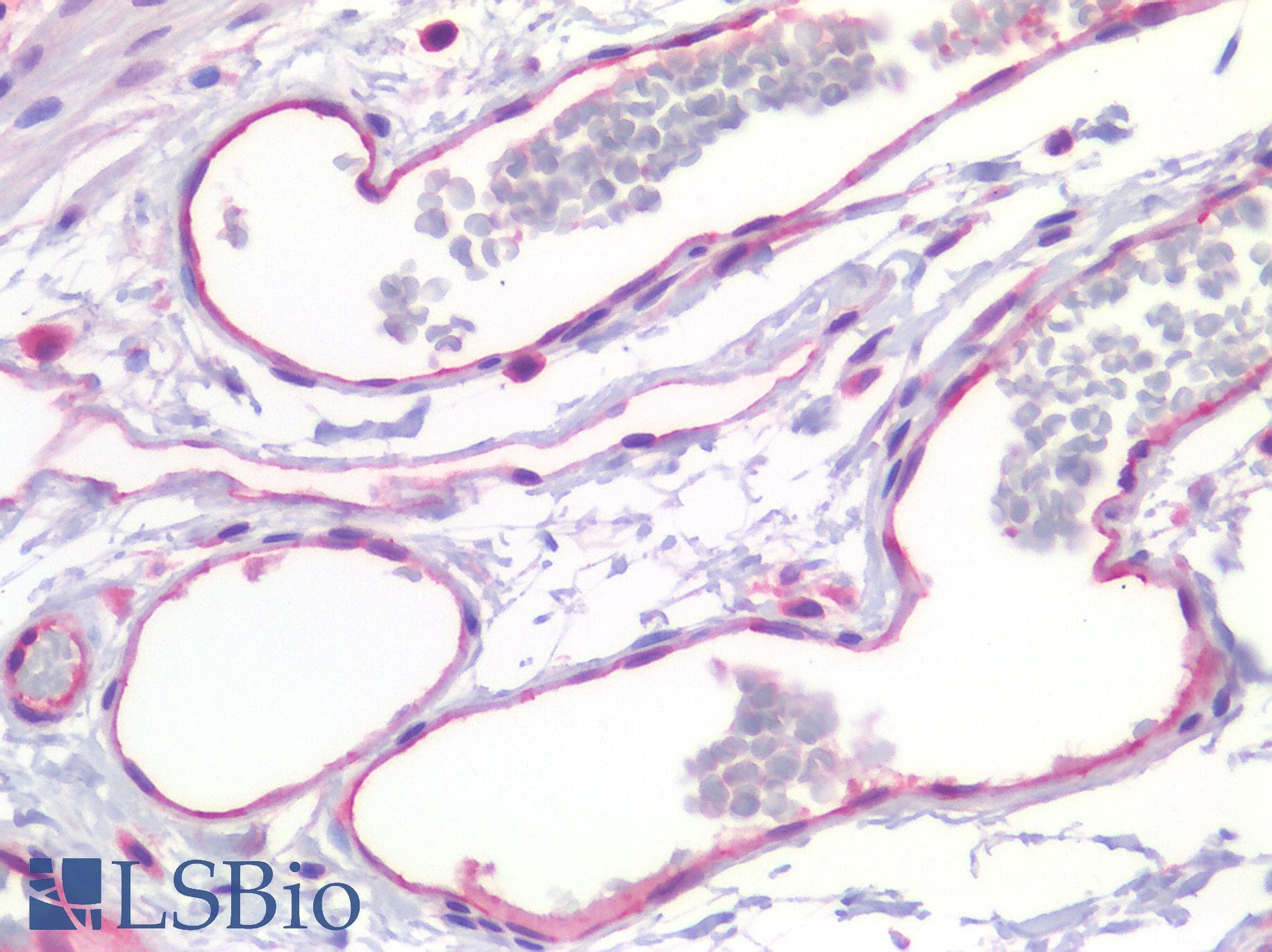 IHC-plus™ PECAM-1 / CD31 Antibody