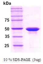 Human PPM1A / PP2CA Protein (Recombinant His)