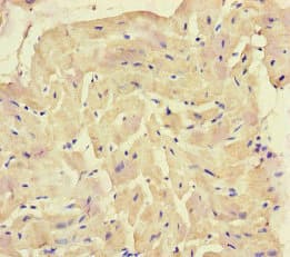 Polyclonal Rabbit anti-Human SQSTM1 Antibody (IHC, IF)