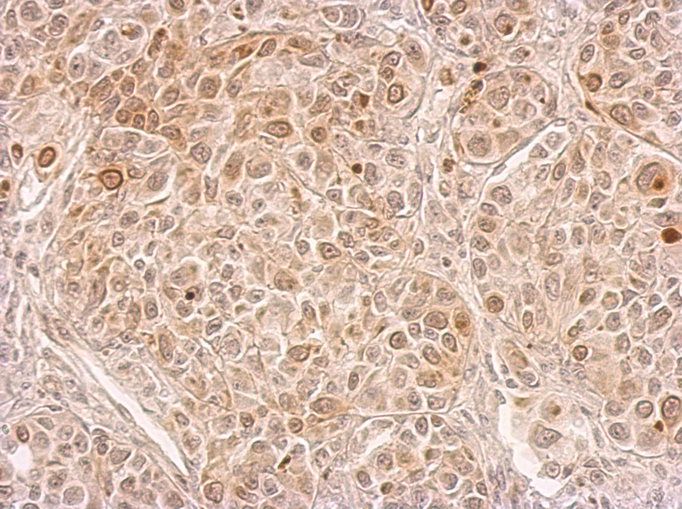 CIAPIN1 / Anamorsin Antibody (aa72-297)