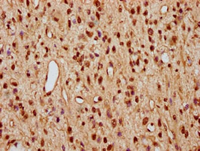 HIST1H2AI Antibody