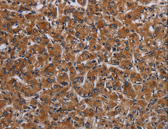 IRGM / LRG-47 Antibody