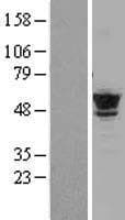 TUBB4B / Tubulin Beta 4B Protein (Over-Expression Lysate Myc-DDK (Flag))
