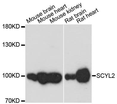 SCYL2 Antibody