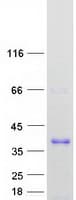 Human SNX29P1 Protein (Recombinant Myc-DDK (Flag))