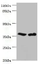 Polyclonal Rabbit anti-Human CA-VB / CA5B Antibody (IHC, WB)