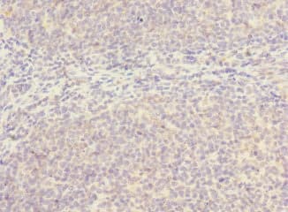 Polyclonal Rabbit anti-Human SLC17A3 Antibody