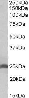 IHC-plus™ APOD / Apolipoprotein D Antibody (aa48-61)