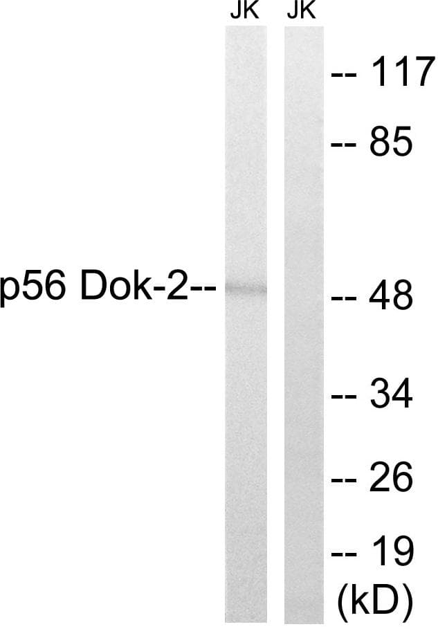 DOK2 Antibody (p345)