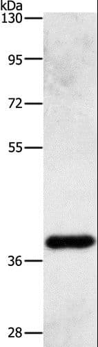 Polyclonal Rabbit anti-Human PRKAG1 / AMPK Gamma 1 Antibody (WB)