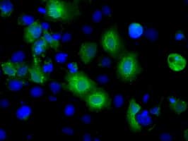 IHC-plus™ Basigin / Emmprin / CD147 Antibody (clone 5D8)