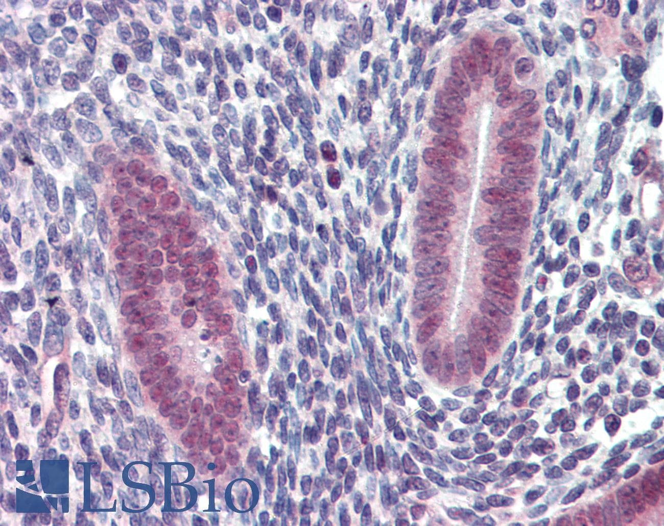 BCL6 Antibody (Internal)