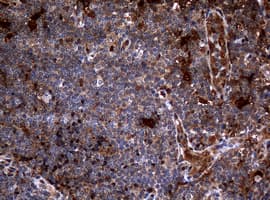 TP / Thymidine Phosphorylase Antibody (clone OTI5B5)