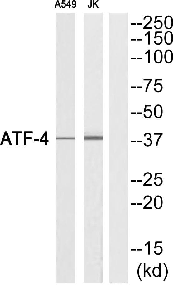 Polyclonal Rabbit anti-Human ATF4 Antibody (Ab-219, WB)