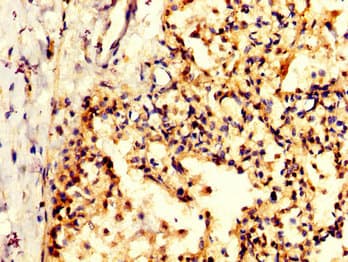 Polyclonal Rabbit anti-Human PPA1 Antibody (IHC)