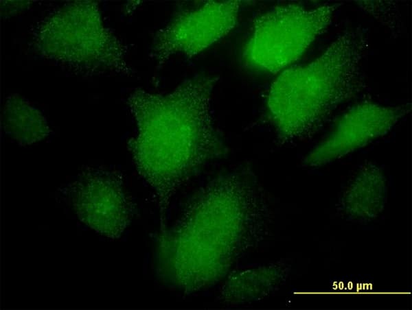 IHC-plus™ PCSK1 Antibody (clone 3D2)