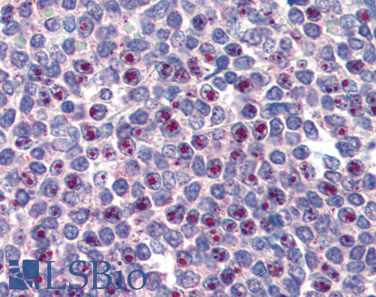 PathPlus™ FOXC1 Antibody (aa541-553)