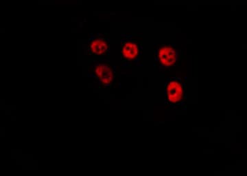 PRX-1 / PRRX1 Antibody
