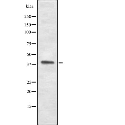Polyclonal Rabbit anti-Human TACR2 / NK2R Antibody (IF, WB)