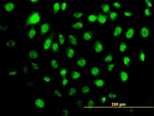 HELZ Antibody (clone 5B2)