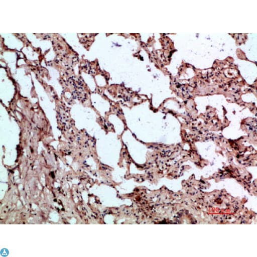 GDF2 / BMP9 Antibody