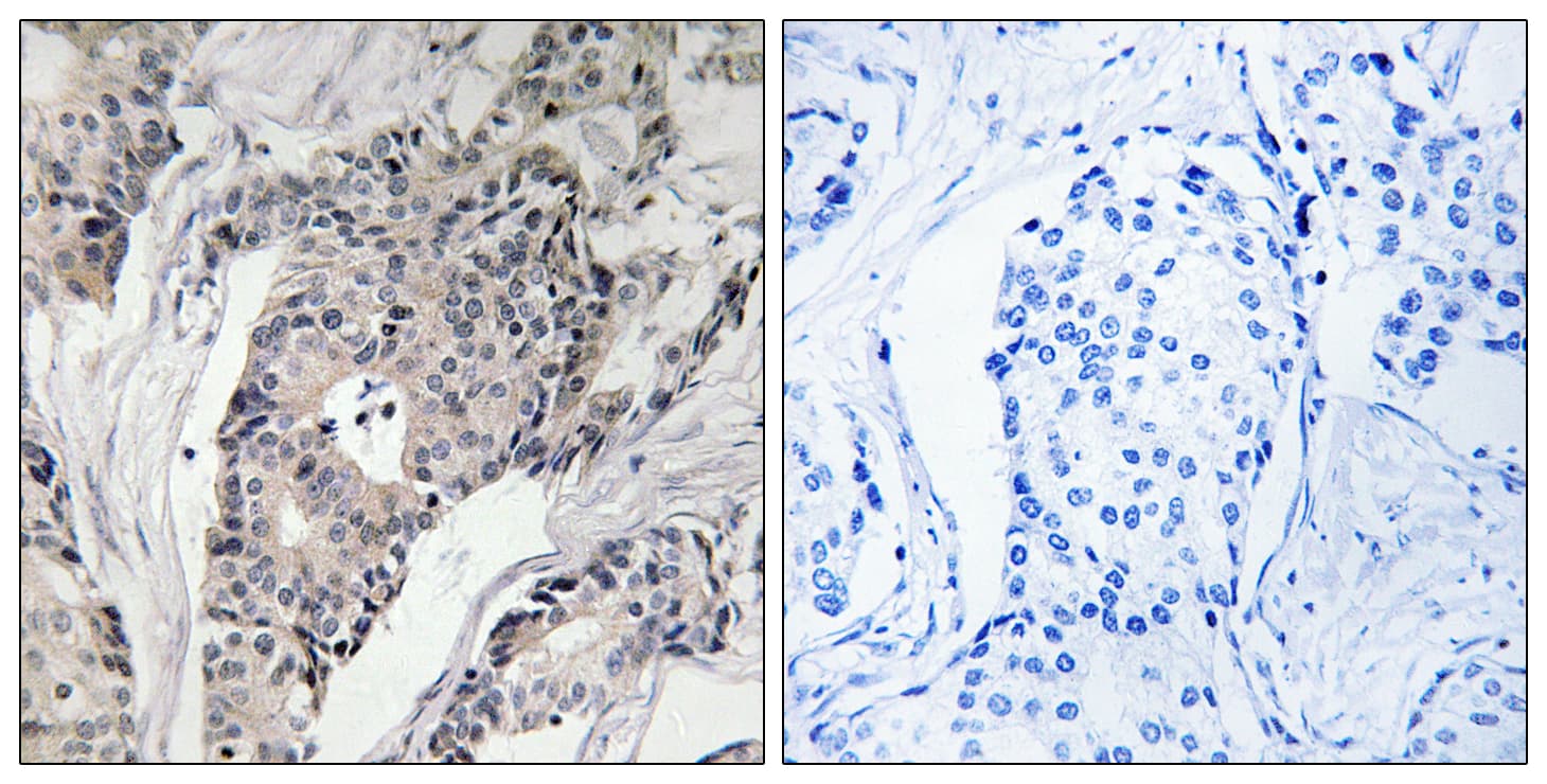 THBS4 / Thrombospondin 4 Antibody (aa561-610)
