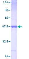 Human PLA2G16 / HRASLS3 Protein (Recombinant GST)