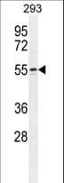 WIPF2 / WIRE Antibody (aa392-419)