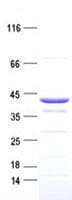Human OTC Protein (Recombinant DDK,C-terminus)