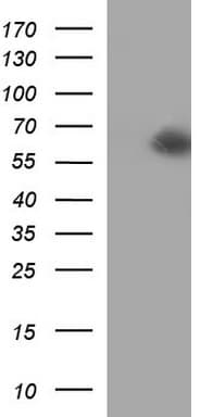 SCARB1 / SR-BI Antibody (clone OTI1E1)
