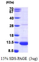 Human DYNLL1 / PIN Protein (Recombinant His)