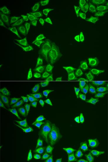 Polyclonal Rabbit anti-Human MLANA / Melan-A Antibody (IHC, IF, WB)