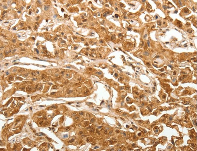 TXN / Thioredoxin / TRX Antibody