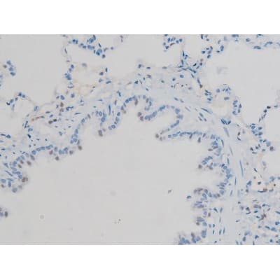 GJA1 / CX43 / Connexin 43 Antibody (phospho-Ser367)