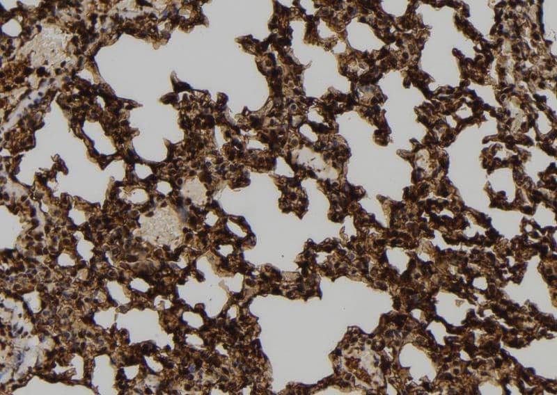 USP46 Antibody