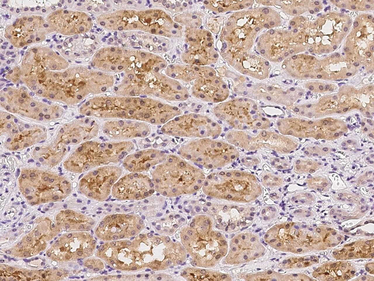 FAM9B Antibody