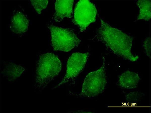 IKBKG / NEMO / IKK Gamma Antibody (clone 4G9)