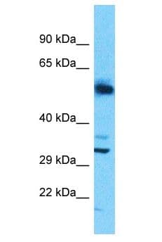 Polyclonal Rabbit anti-Human SLC25A30 Antibody (aa22-71, WB)